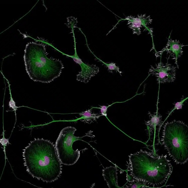 Жизнь под микроскопом: 11 победителей фотоконкурса Nikon Small World 2024