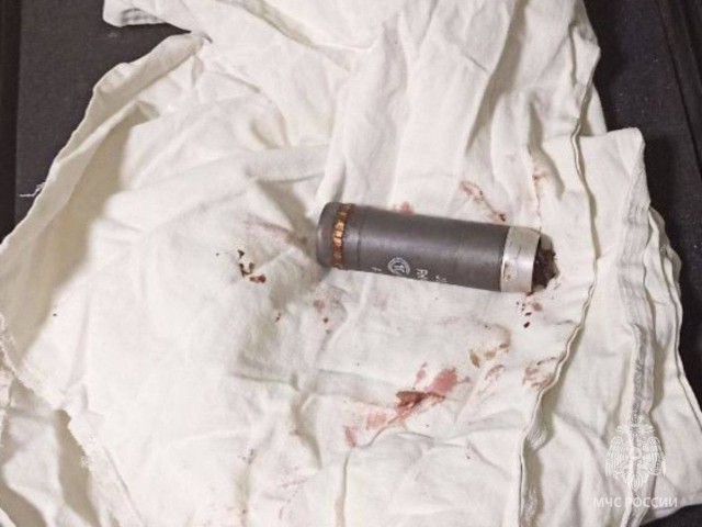 В День Медицинского работника донецкие врачи извлекли из грудной клетки военнослужащего неразорвавшуюся гранату