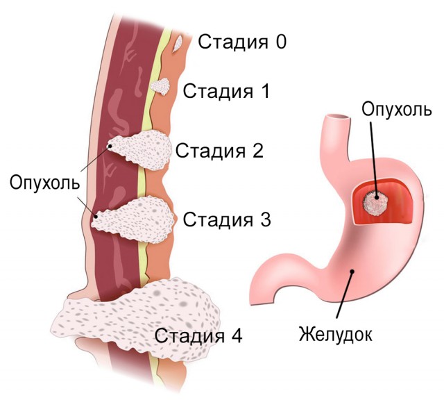Пандемия. Коронавирус. Россия и мир. Часть 29