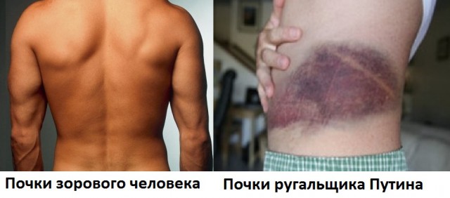 Как я бросил ругать Путина