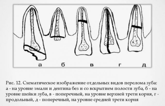 Помощь при эпилепсии