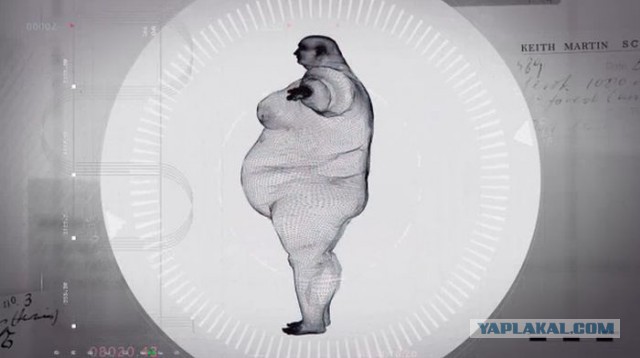 Рентгеновский снимок тела 400-кило-го мужчины