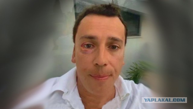 Вот походу (Г)Алкин договорился, Кремль его списал.
