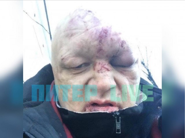 В Петербурге у бара «Руки Вверх» ограбили Барецкого. Шоумена увезли в больницу