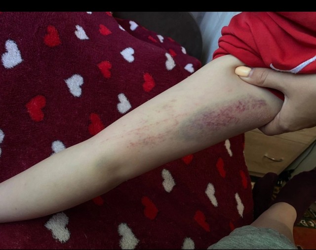 В Калужской области на праздновании Дня города под танцующими школьницами рухнула сцена