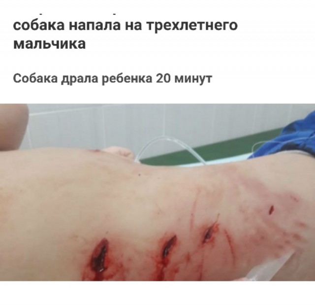 В Екатеринбурге собака напала на мальчика и грызла его 20 минут