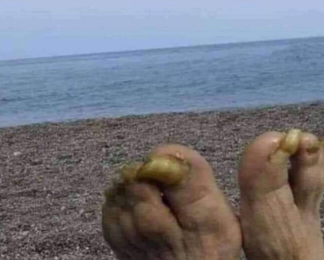 На пляжах Анапы закончились не только лежачие, но и сидячие места. Загорать там можно только стоя