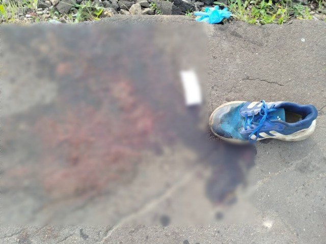 В Подмосковье альтернативно одаренному 11 летнему зацеперу поезд внезапно отрезал ногу.