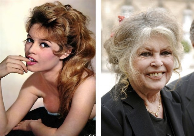 Знаменитости, которые безобразно стареют