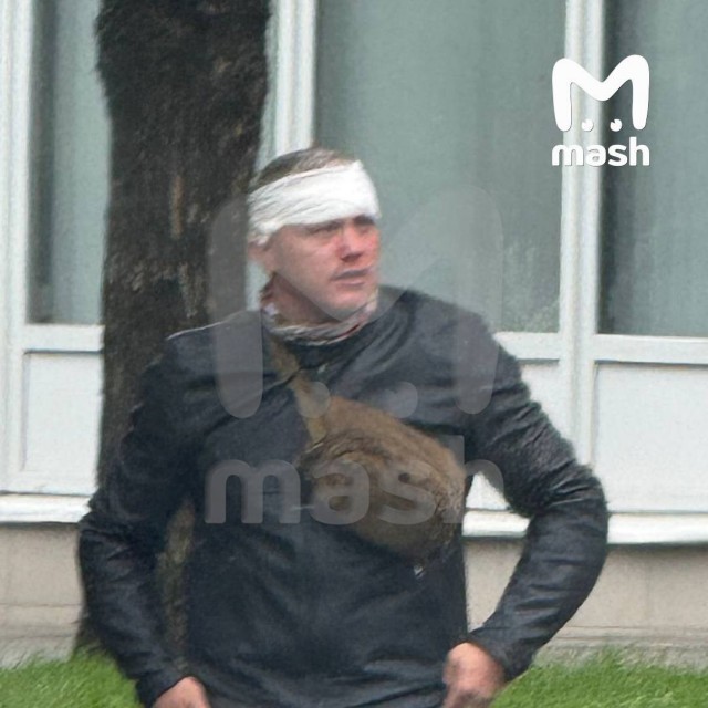 Алексею Блиновскому разбили голову и нос — за то, что муж королевы марафонов снёс зеркало автомобиля на перекрёстке на Шаболовке.