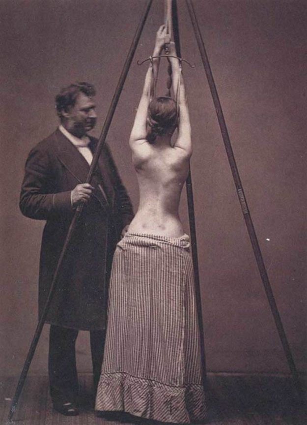 17 удивительных медицинских снимков из прошлого