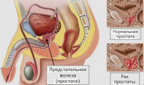 Готовьте помидоры правильно и это спасёт вас от рака. Научное исследование