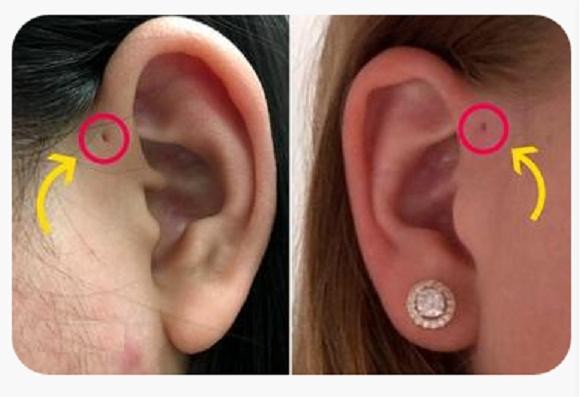 У некоторых людей есть крошечные отверстия на ушах, никто не знает зачем, но есть теория
