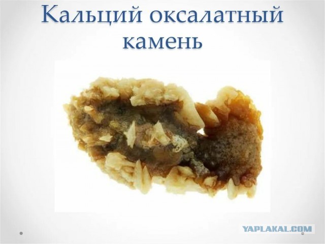 Пандемия. Коронавирус и съехавшие крыши. Россия и мир. Часть 35