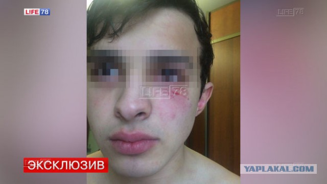 В Петербурге учитель избил школьника на уроке физкультуры