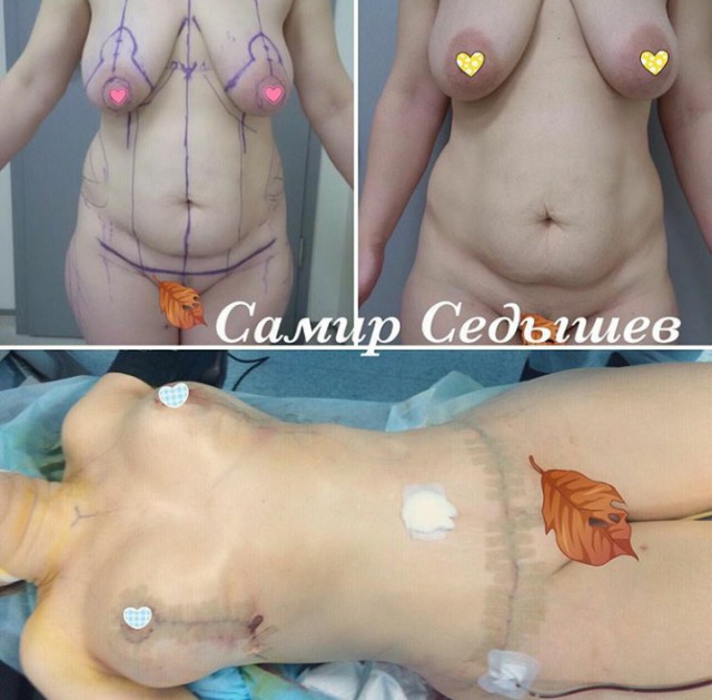 Попка краником