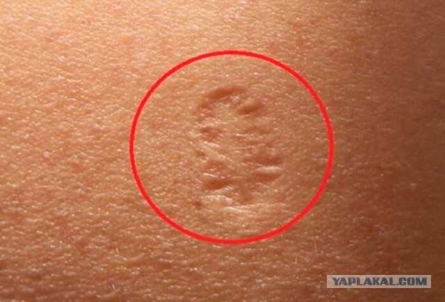 В Ирландии произошла новая массовая вспышка COVID, несмотря на 91% вакцинации населения