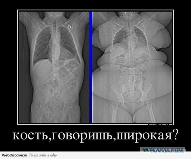 Ей хотелось хорошо выглядеть на свадьбе