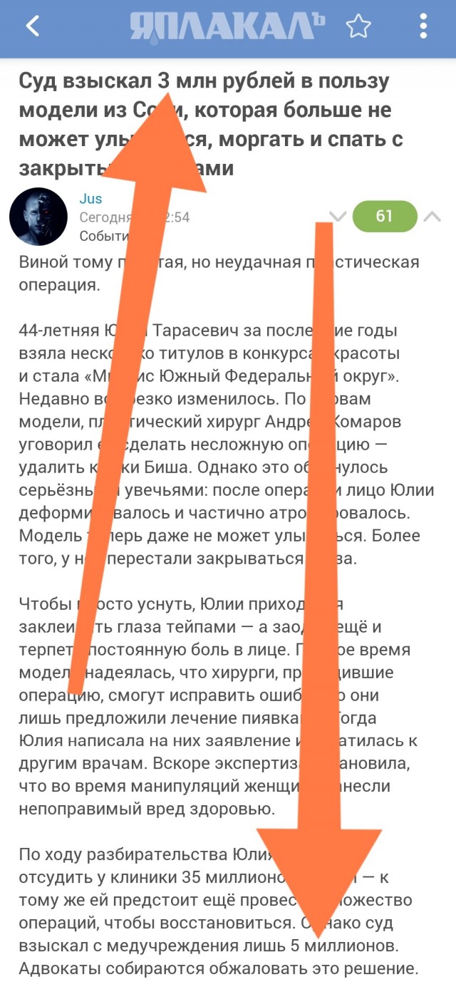 Суд взыскал 3 млн рублей в пользу модели из Сочи, которая больше не может улыбаться, моргать и спать с закрытыми глазами