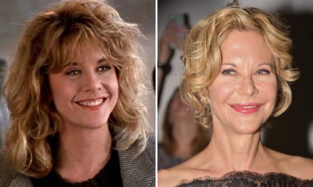 8 наших и зарубежных звезд, которые изуродовали себя пластикой