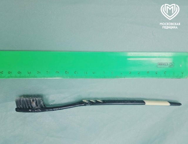Женщина чистила зубы и проглотила щетку длиной 18 см⁠⁠