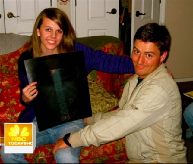 Самые неожиданные вещи, найденные в теле человека