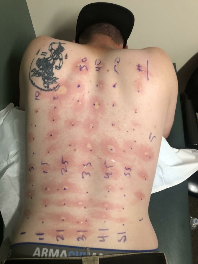 Подборка фотографий, некоторые из них заставят вас сморщиться от неприязни