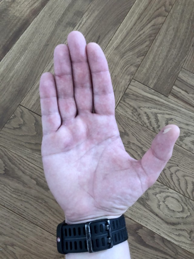 Вдогонку теме, которая в золоте