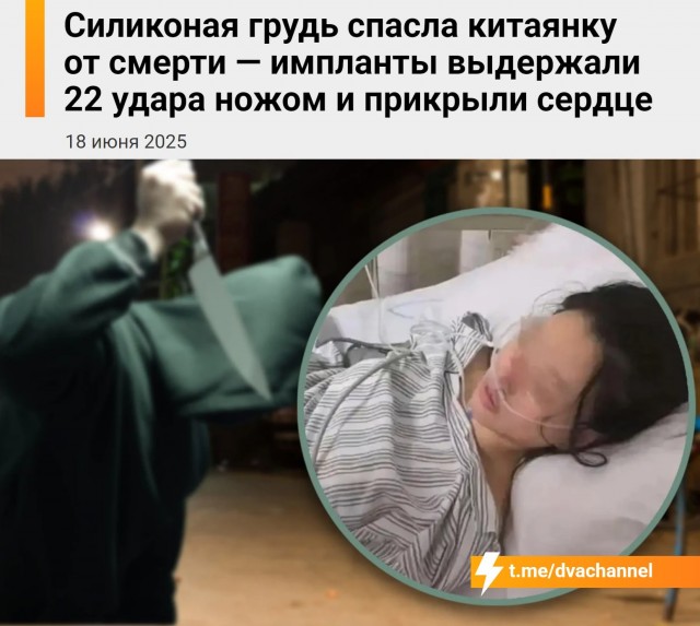 Силиконовая грудь спасла китаянке жизнь — импланты выдержали 22 удара ножом и закрыли сердце
