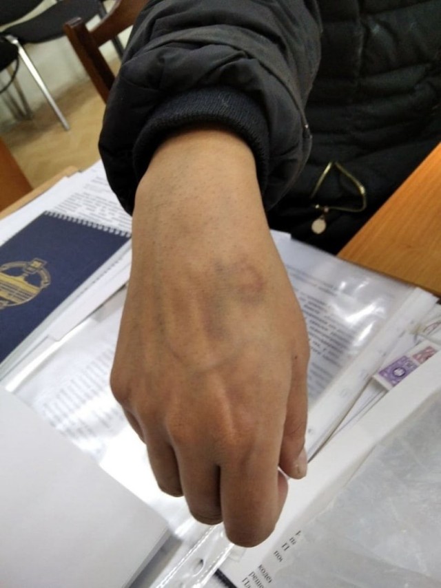 Приковали к ограде, чтобы выбить признание