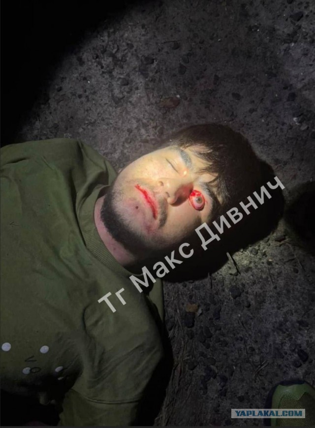 Одного из терроистов допрашивают в реанимации