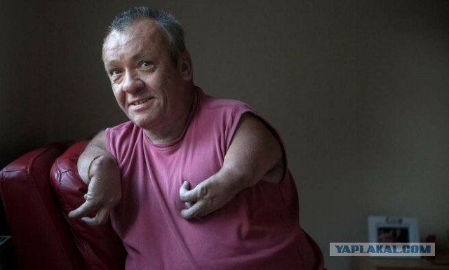 Ошибка фармацевтов, которая стоила жизни тысячам младенцев