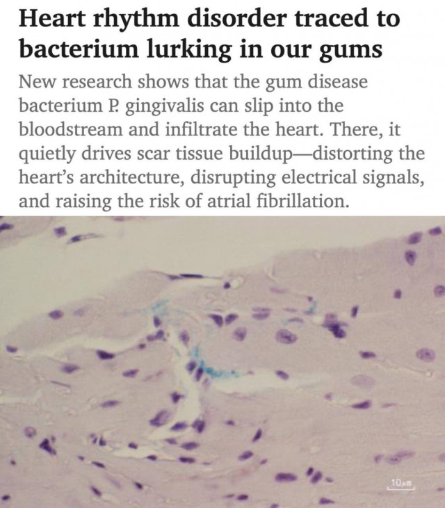 Нечищенные зубы вызывают проблемы с сердцем