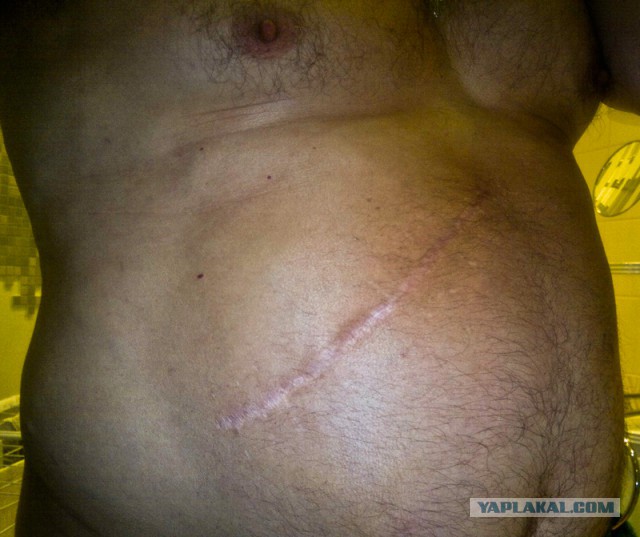 Расскажу и я про больницу и ОМС