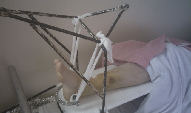 Kак я очередной раз лежал в больнице