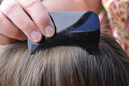 В Австралии мать-веган отказывается травить вшей у дочери, потому что она против убийства животных