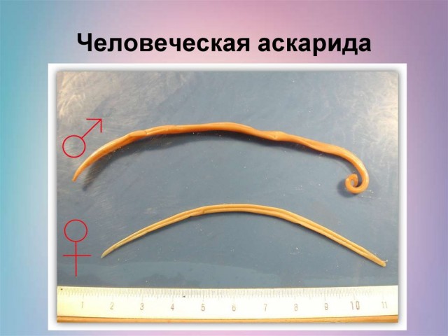 По-моему она переборщила с похудением