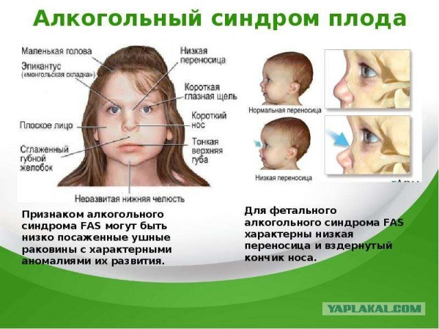 Ответ на видео, где пленным простреливают ноги