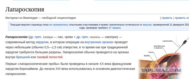 Кое что о вазэктомии⁠⁠