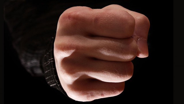 Российский работодатель сломал нос сотруднику, захотевшему уволиться