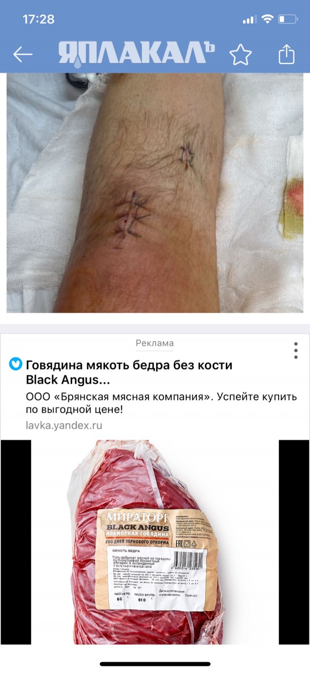 Сказ о том, как я шел домой и сломал ногу в двух местах