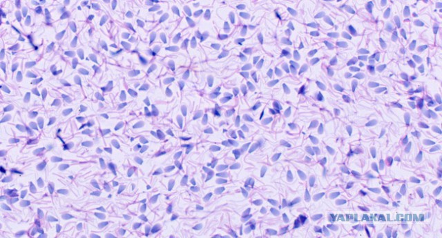 Мир в миллиметре