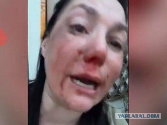 Звезда "Бумера" Дарья Мищенко обвинила украинцев в избиении в Италии
