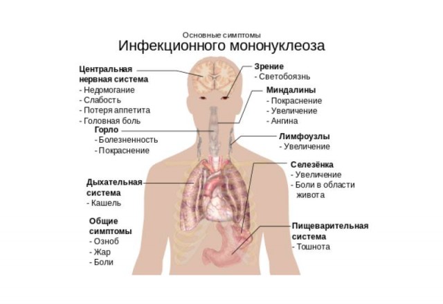 Пандемия съехавших крыш - разновидности болезни. Россия и мир. Часть 40.