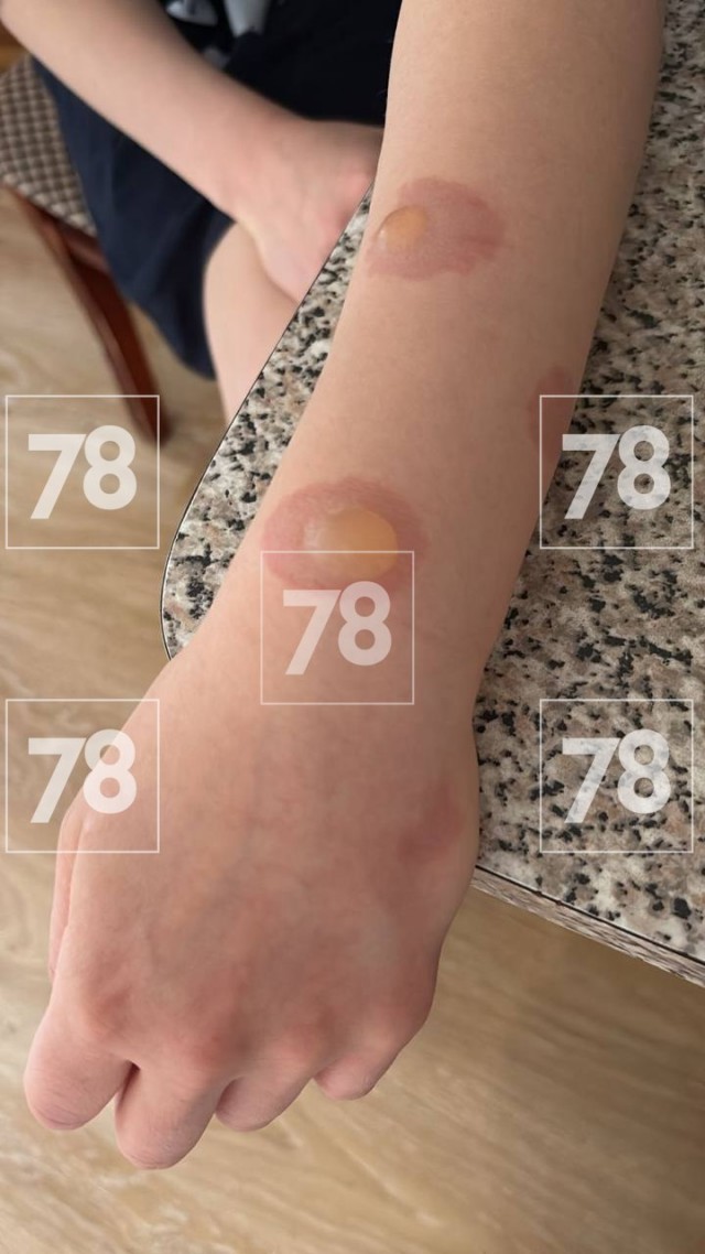 Подростковые тренды, бессмысленные и беспощадные