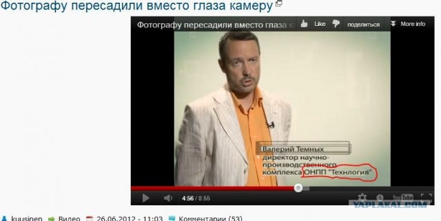 Фотографу пересадили вместо глаза камеру