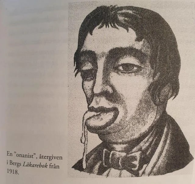 Внешность онаниста, согласно шведскому учебнику по медицине 1918 года