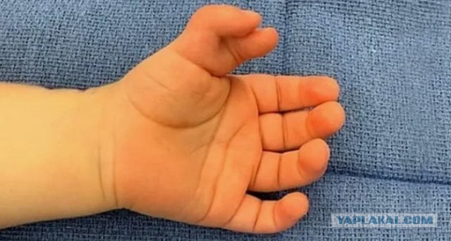 Смартфонной кисти» массово ставят россиянам 18–35 лет