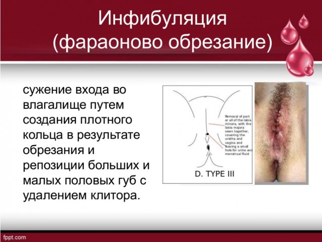 О тараканах в женских головах. Часть 8