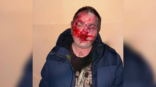 В Крыму избили посетителей кафе